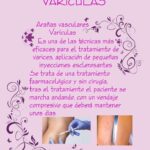 esclerosis-variculas
